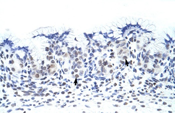 ZNF70 Antibody