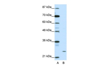 ZNF253 Antibody