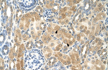 NR2F2 Antibody