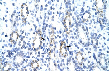 GTF2IRD1 Antibody