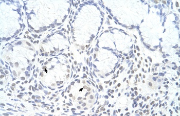 ZNF580 Antibody