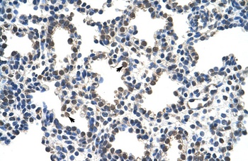 RCOR1 Antibody