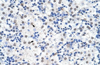 IKZF3 Antibody