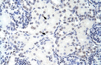 GMEB2 Antibody