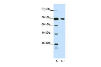 TRIM32 Antibody