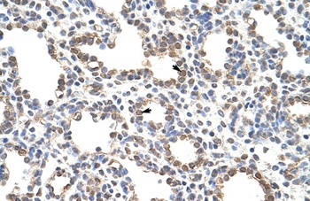 ZNF195 Antibody
