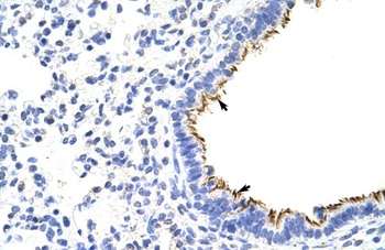 ZNF16 Antibody