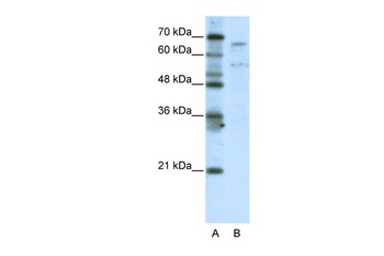TAF6L Antibody