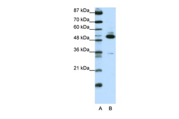 TADA3L Antibody