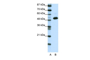 TADA3L Antibody