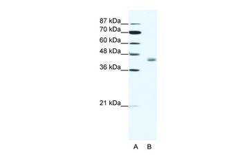 LDB2 Antibody