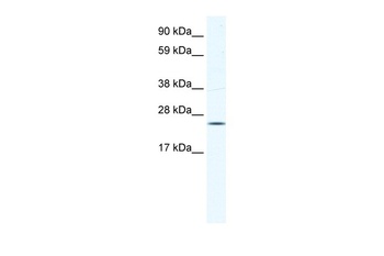 KCTD6 Antibody
