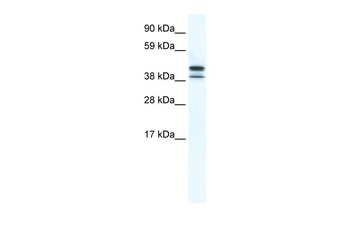 Tbpl2 Antibody