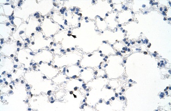 MYBBP1A Antibody