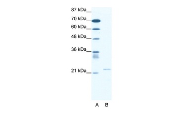 TRPM3 Antibody