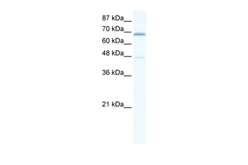 CACNB2 Antibody