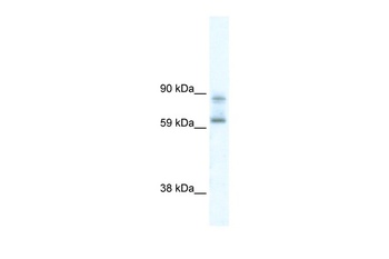 DDX42 Antibody