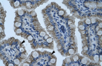 ZNF461 Antibody