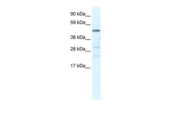 HSFY1 Antibody