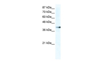 ZNF556 Antibody