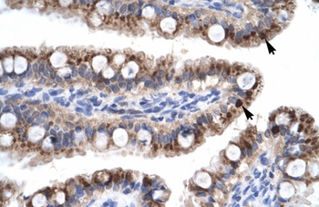 ZNF167 Antibody