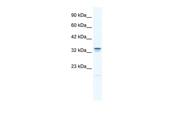 ANKZF1 Antibody