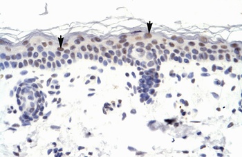 ZNF223 Antibody