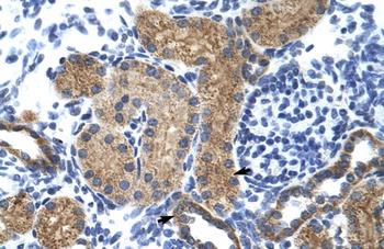 GTF3C5 Antibody