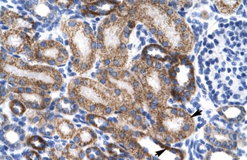 ZNF75 Antibody