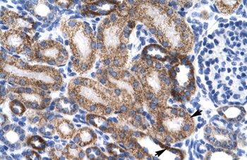 ZNF75D Antibody