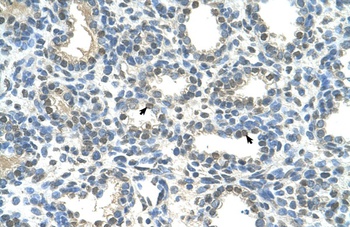 HOXC9 Antibody