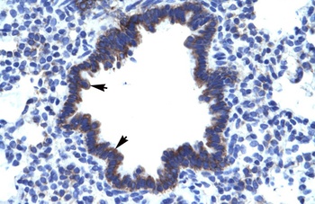 CHST4 Antibody