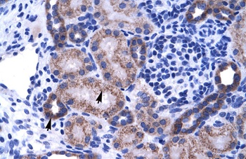 ZNF84 Antibody