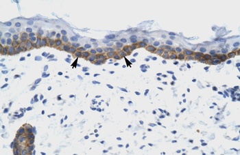NUDT9 Antibody