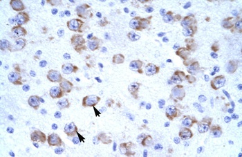 CATSPER2 Antibody