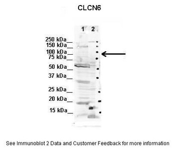CLCN6 Antibody
