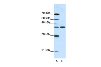 NMUR2 Antibody