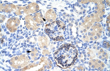 CLIC5 Antibody