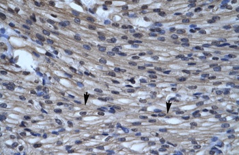 CLC5 Antibody