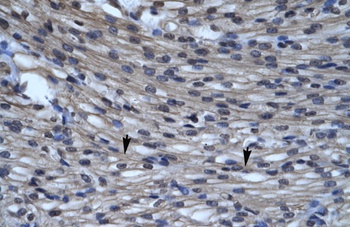 CLIC5 Antibody