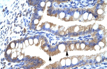 CLIC5 Antibody