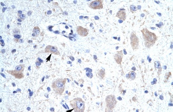 KCNIP1 Antibody