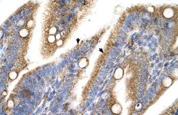 TRPM5 Antibody