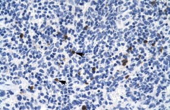 HTR3B Antibody