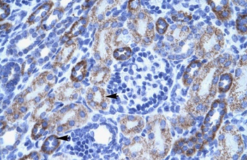 ASIC3 Antibody