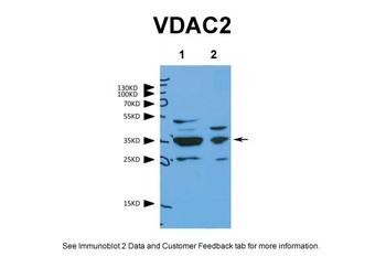 VDAC2 Antibody