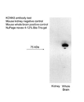 KCNN3 Antibody