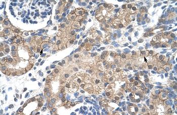 CHRNB2 Antibody