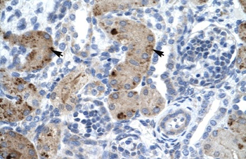 ZMYM6 Antibody