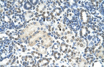 ZMYND11 Antibody